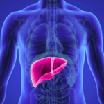 colangiocarcinoma